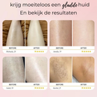 30 dagen proberen en eenvoudig retourneren