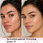 7 kleuren LED masker